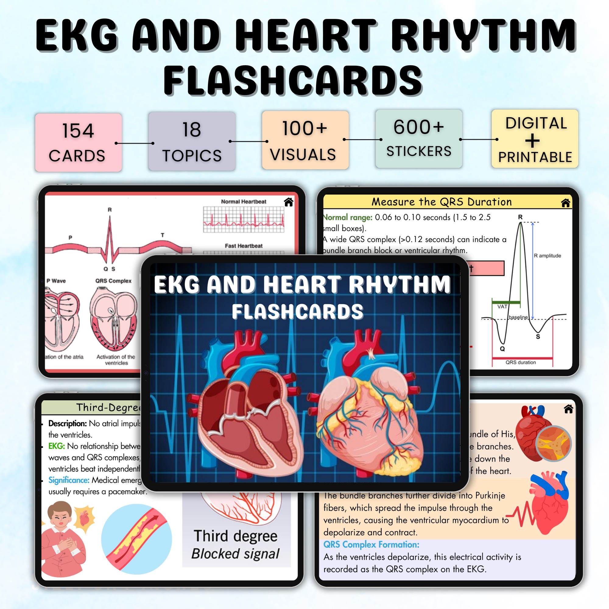 150 EKG And Heart Rhythm Flashcards EKG Study Guide ECG Or Ekg Interpretation Cardiac Study Guide Ekg Rhythms Nursing Notes Etsy