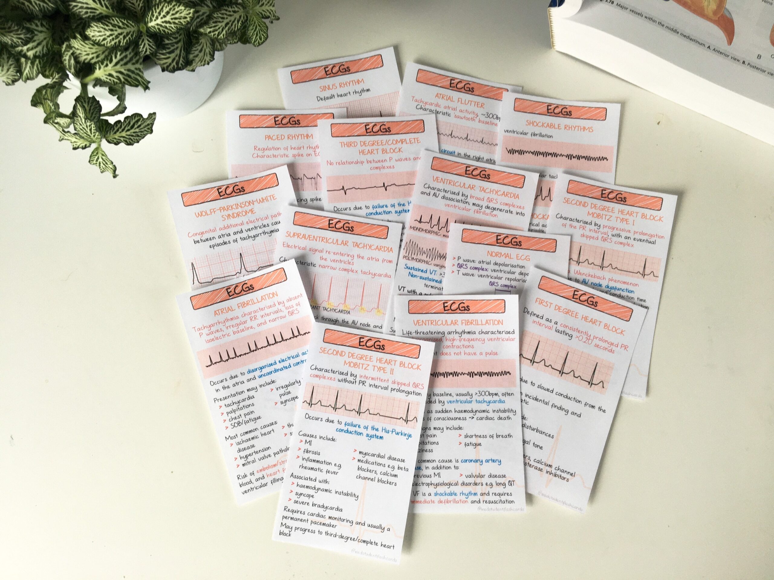 ECG Rhythms Flashcards PDF Worksheets Library