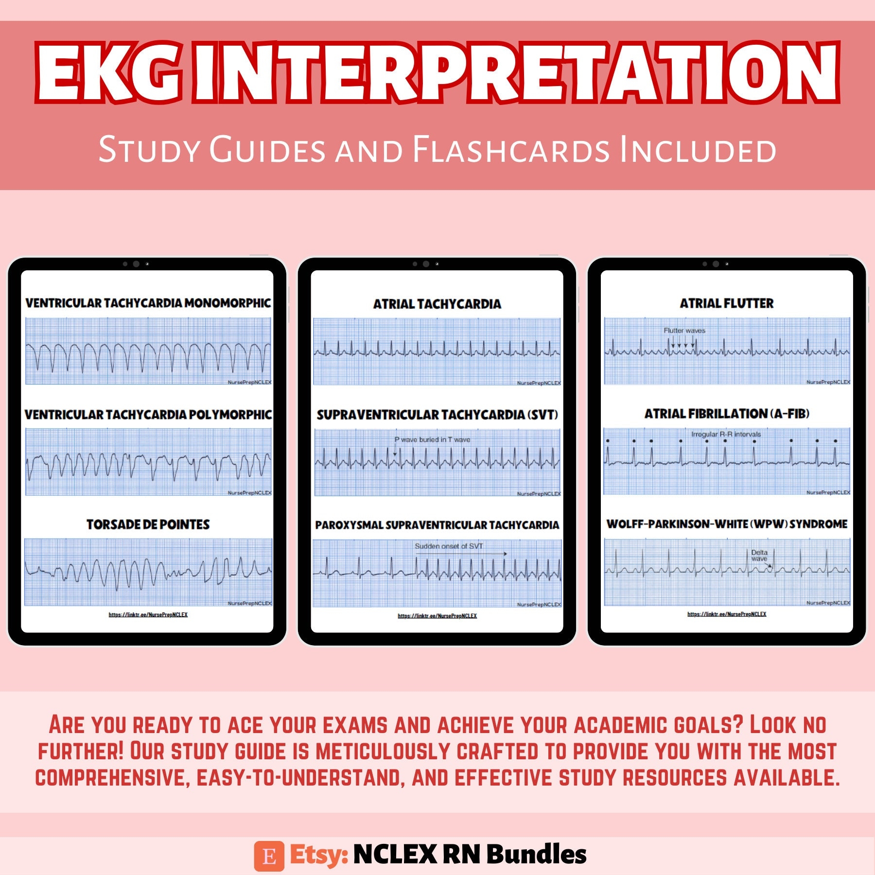 EKG Dysrhythmia Interpretation Flashcards PDF Instant Download Etsy