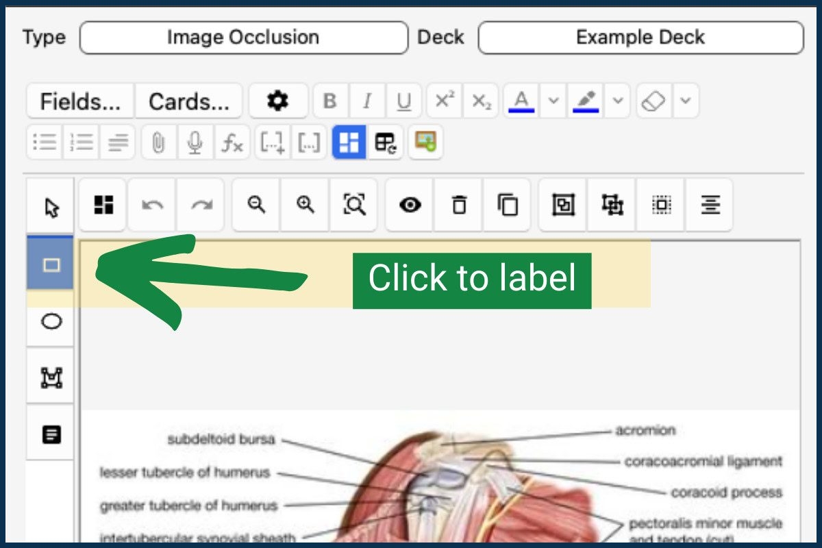 How To Use Anki The Easiest Guide For Med Students MedSchoolCoach